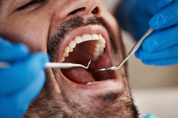 Best Emergency Treatment for Dental Infections or Abscesses in Minden, NE
